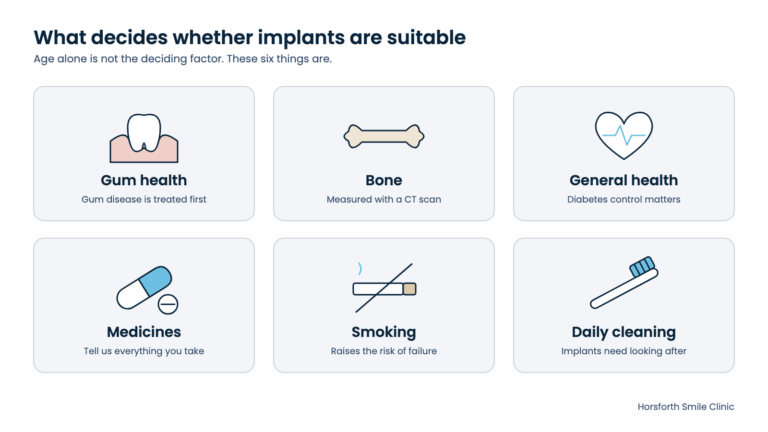 Read more about the article Dental Implants for Over 60s: Age, Health, Cost and the NHS